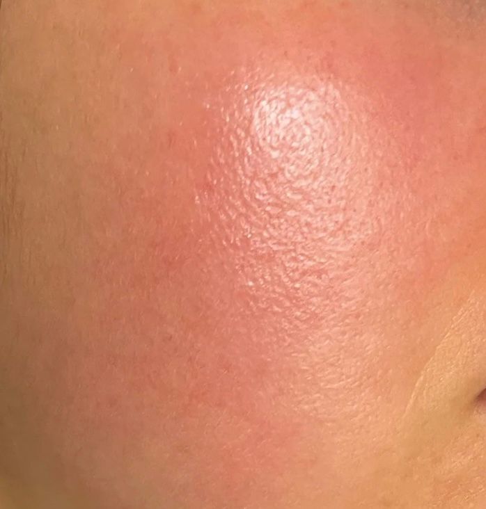 The Pizza Guide to Skin Barrier Repair for Pakistani Women