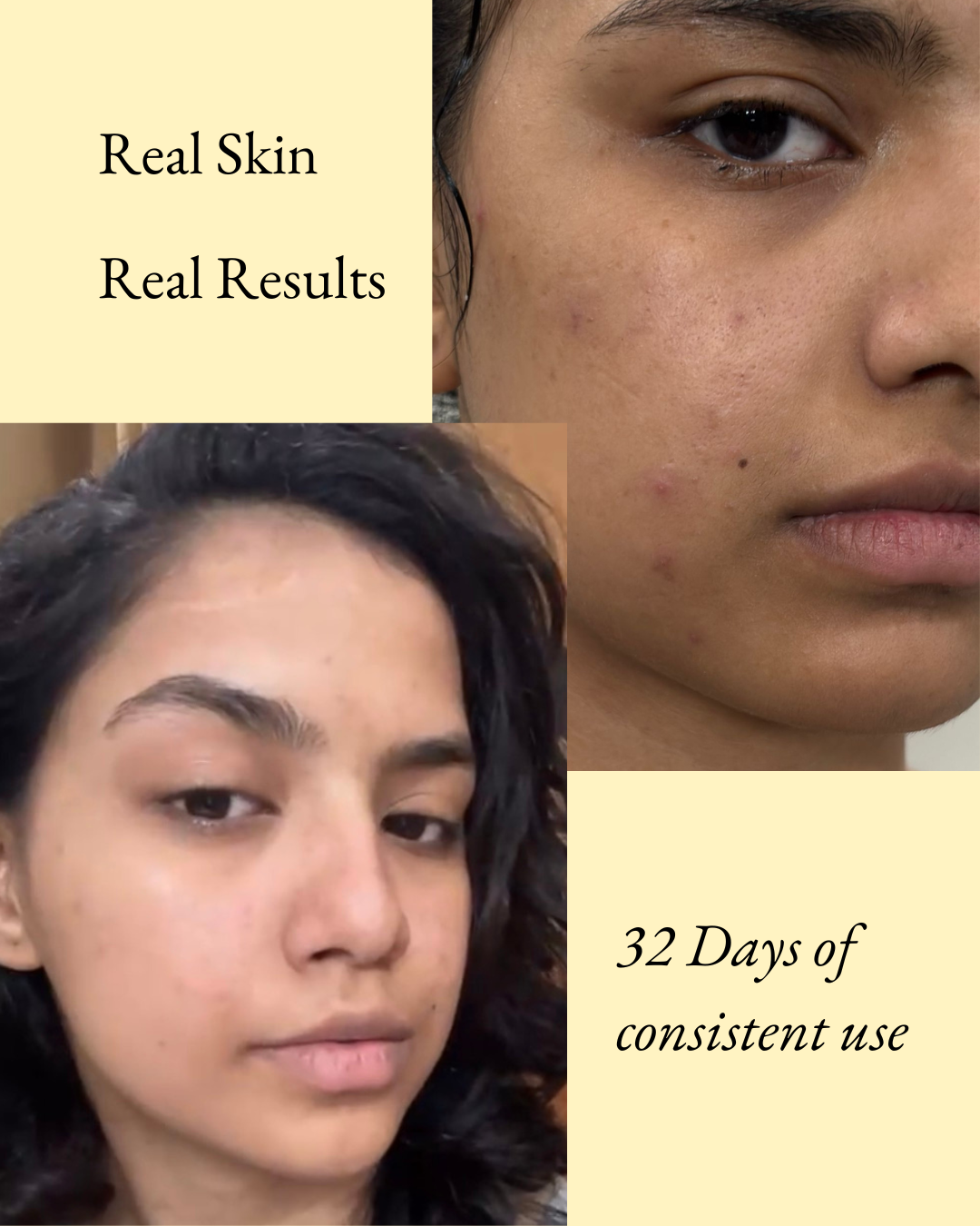 Cleartone Moisturiser